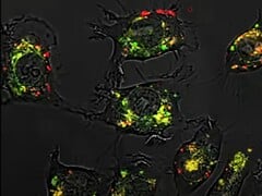 Grâce aux acides nucléiques sphériques, le composé 5-fluorouracile a été 20 000 fois plus efficace que d'habitude dans les études animales. (Source de l'image : Northwestern University)
