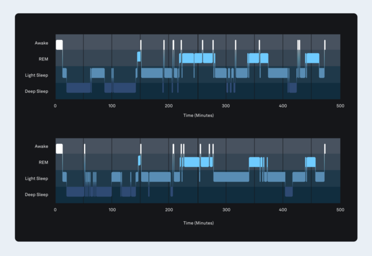 Le nouvel algorithme Oura de stadification du sommeil (en bas) est montré ici comme étant 84% plus précis que la polysomnographie (en haut). (Image source : Oura)