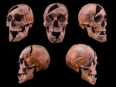 Le crâne de l'individu examiné provient du monastère dominicain du XIIIe siècle de l'île Margaret, à Budapest (Crédit photo : Université Eötvös Loránd)