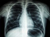 Image radiographique d'un torse humain (Source de l'image : Umanoide via Unsplash ; recadré)