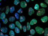 Image montrant des cellules souches obtenues à partir de la peau d'une femme (Source de l'image : UCLA via CIRM)