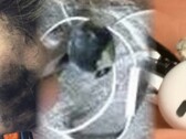 L'explosion fatale des écouteurs est la dernière défaillance choquante d'un appareil audio personnel. (Image source : Neowin/Times of India/WFLA - édité)