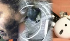 L'explosion fatale des écouteurs est la dernière défaillance choquante d'un appareil audio personnel. (Image source : Neowin/Times of India/WFLA - édité)