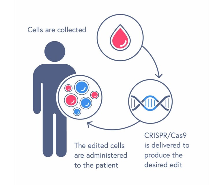 Le traitement CASGEVY consiste à transfuser des cellules souches sanguines modifiées. (Source : CRISPR Therapeutics)