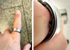Un Samsung Galaxy Ring dont la batterie était gonflée a contraint un utilisateur à se rendre à l'hôpital. (Source de l'image : Zone of Tech)