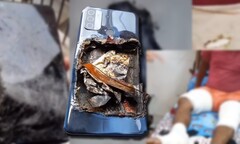 L&#039;Oppo A53 aurait explosé, laissant son propriétaire blessé aux deux jambes. (Image source : Technical Dost - édité)