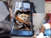 L'Oppo A53 aurait explosé, laissant son propriétaire blessé aux deux jambes. (Image source : Technical Dost - édité)