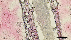 estructura tubular de células testiculares impresa en 3D (imagen: UBC)
