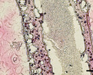 Des scientifiques canadiens impriment en 3D des tubes de cellules testiculaires fonctionnels, précurseurs de nouveaux traitements contre l'infertilité