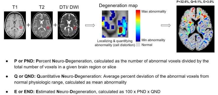 BrainSee peut détecter des zones anormales du cerveau à partir d'une IRM et donner aux médecins un score indiquant la probabilité qu'un patient développe la maladie d'Alzheimer. (Source : Darmiyan)