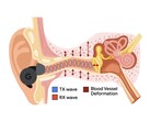 L'APG utilise des tonalités ultrasoniques modulées par les changements de pression dans le canal auditif (Image Source : Google Research)