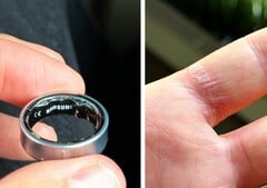 Une pile gonflée dans un anneau Galaxy peut être douloureuse. (Source d'image : Zone of Tech)