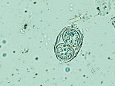Toxoplasma gondii présenté ici sous la forme d'un œuf infectieux. (Source de l'image : Todorean Gabriel/iStock/Getty Images Plus)