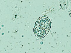 Toxoplasma gondii présenté ici sous la forme d&#039;un œuf infectieux. (Source de l&#039;image : Todorean Gabriel/iStock/Getty Images Plus)