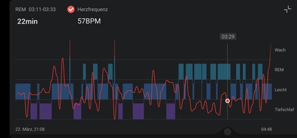 Avis sur la smartwatch Amazfit Band 7