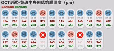 D'après une étude interne menée sur le site Honor, la plupart des participants ont constaté un effet positif sur la myopie temporaire, mesurée par l'épaisseur de la choroïde à l'arrière de l'œil. (Source de l'image : 胜利文绉绉 sur BiliBili)