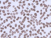 Globules rouges formant des rouleaux. (Source de l'image : Wikimedia Commons)