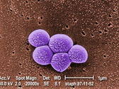 Integrated Biosciences découvre une nouvelle classe d'antibiotiques efficaces contre les bactéries résistantes MRSA. (Source : Bibliothèque d'images de la santé publique #9994)