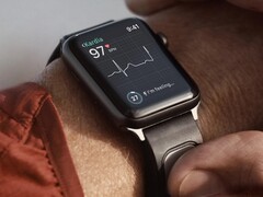 Le KardiaBand est un bracelet de surveillance ECG conçu pour la montre Apple. (Source de l'image : Kardia)
