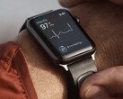 Le KardiaBand est un bracelet de surveillance ECG conçu pour la montre Apple. (Source de l'image : Kardia)