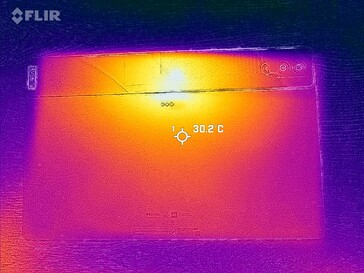 Imagerie thermique : dos