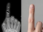 Bone Biologics dépose un brevet pour une nouvelle technologie de régénération osseuse (Source de l'image : image illustrative générée par l'IA)
