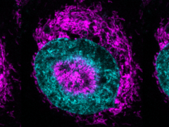 Cellule cancéreuse confinée (photo) - on peut voir les mitochondries de couleur magenta s'accumuler à la périphérie nucléaire de couleur cyan et à l'intérieur des indentations nucléaires. (Source de l'image/de la légende : Rito Ghose et Fabio Pezzano/Centro de Regulación Genómica)
