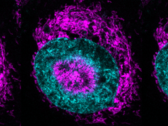 Cellule cancéreuse confinée (photo) - on peut voir les mitochondries de couleur magenta s'accumuler à la périphérie nucléaire de couleur cyan et à l'intérieur des indentations nucléaires. (Source de l'image/de la légende : Rito Ghose et Fabio Pezzano/Centro de Regulación Genómica)