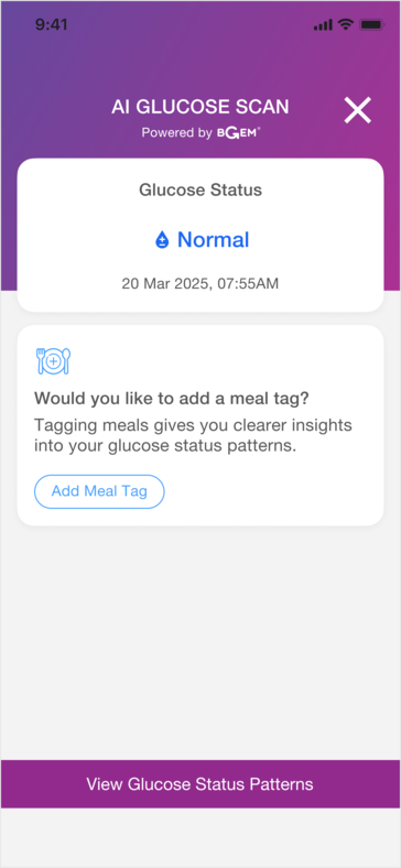 La bague intelligente pourrait être utile pour découvrir les liens entre certains aliments et le taux de glycémie de l'utilisateur