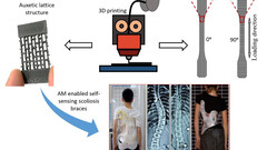 Support dorsal adaptable imprimé en 3D (image : Université de Glasgow)