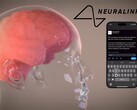 La vision de Neuralink : le contrôle total des appareils numériques par la pensée (Image Source : Neuralink)