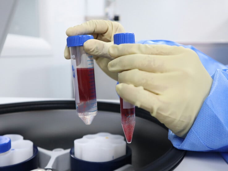 Les laboratoires d'analyses sanguines font partie des services du NHS perturbés par la cyberattaque de la chaîne d'approvisionnement de Synnovis (Image source : Unsplash/Malcolm Choong)