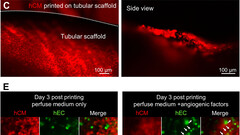 Le tissu cardiaque bioprint a continué à battre pendant six mois (image : Bioactive Materials)