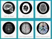 Le logiciel d'IA médicale BrainSee de Darmiyan peut détecter les signes de la maladie d'Alzheimer à un stade précoce. (Source : Darmiyan)