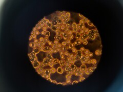 Cellules sanguines sous un microscope (Image source : ThisisEngineering via Unsplash ; recadré)