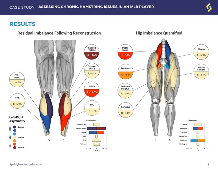 Les rapports de Springbok Analytics détaillent les muscles individuels grâce à des scans IRM 3D. (Source : Springbok Analytics)