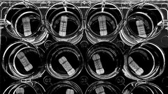 Organoïdes de foie bio-imprimés (image : Université d'Utrecht)