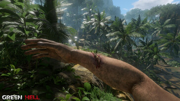 Une image montrant une blessure dans l'Enfer vert.