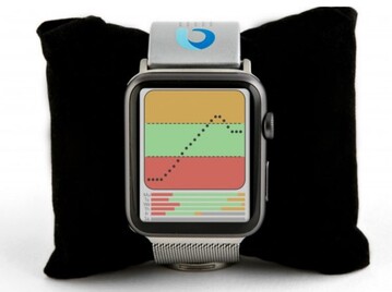 Concept avec le moniteur intégré à une montre Apple. (Source de l'image : Iterate)
