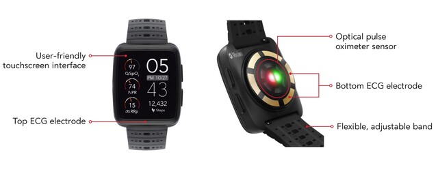 La montre Masimo W1 est conçue pour une surveillance constante de la SpO2 et d'autres paramètres vitaux. (Source : Masimo)
