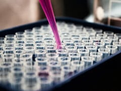 Un test sanguin rapide promet des réponses plus rapides aux familles confrontées à des maladies génétiques rares (Source de l&#039;image : Louis Reed, Unsplash)