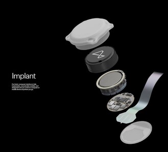Les différents composants de l'implant Neuralink. (Source : Neuralink)